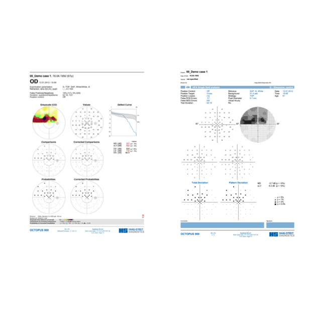 Octopus 600 - Octopus & HFA view